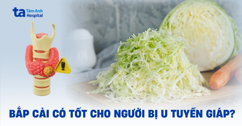 bắp cải có tốt cho người bị u tuyến giáp không