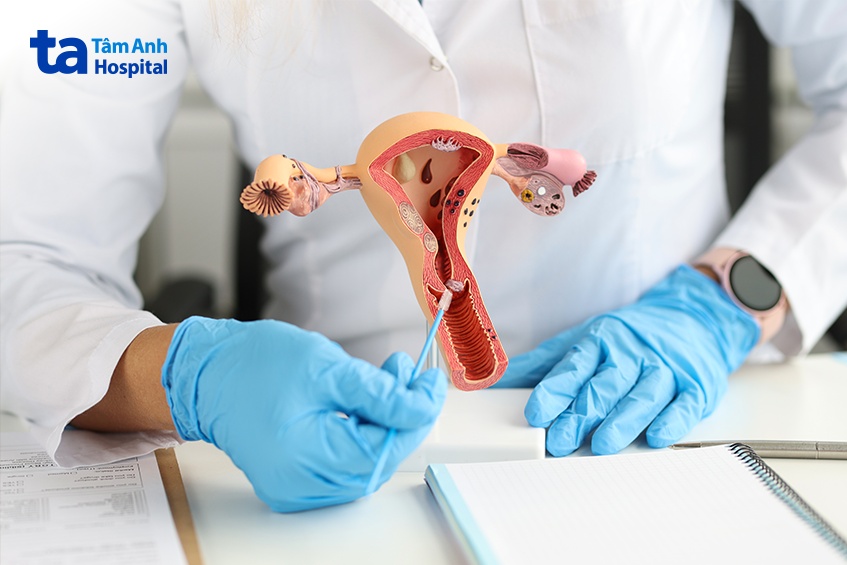 Bất kỳ khiếm khuyết nào trong cấu trúc tử cung cũng có thể là nguyên nhân làm người phụ nữ khó mang thai