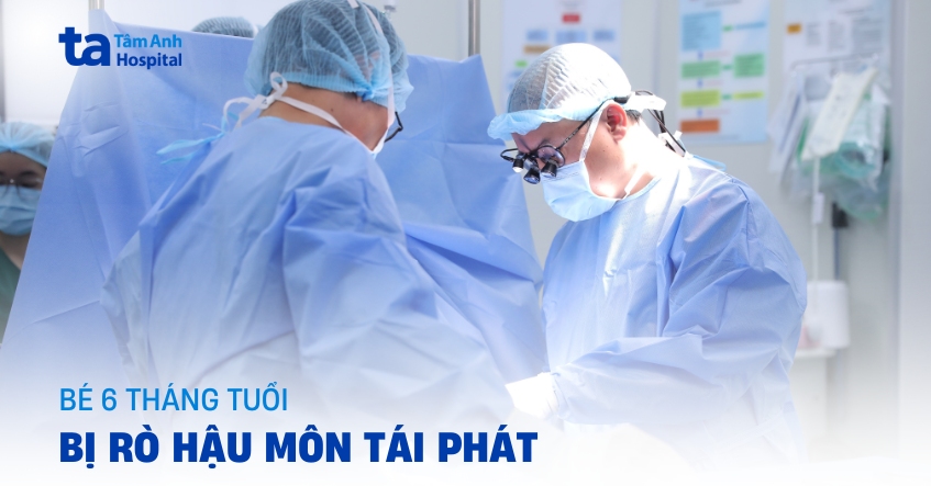 Bé 6 tháng tuổi rò hậu môn tái phát