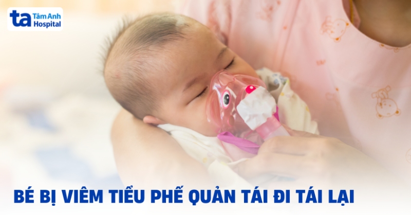 Bé bị viêm tiểu phế quản tái đi tái lại do đâu? Phòng ngừa tái phát