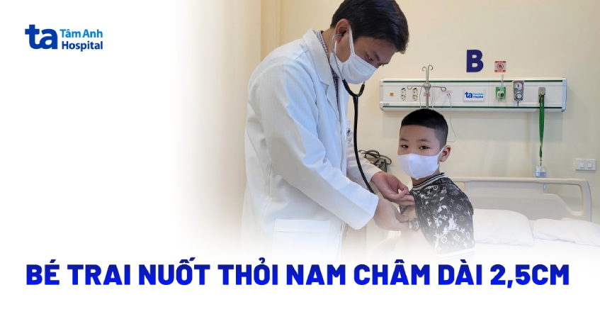 Bé trai nuốt thỏi nam châm dài 2,5cm