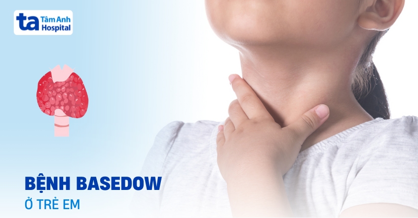 Tìm hiểu thông tin về bệnh Basedow ở trẻ em