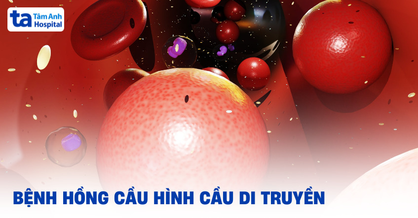 Bệnh hồng cầu hình cầu di truyền