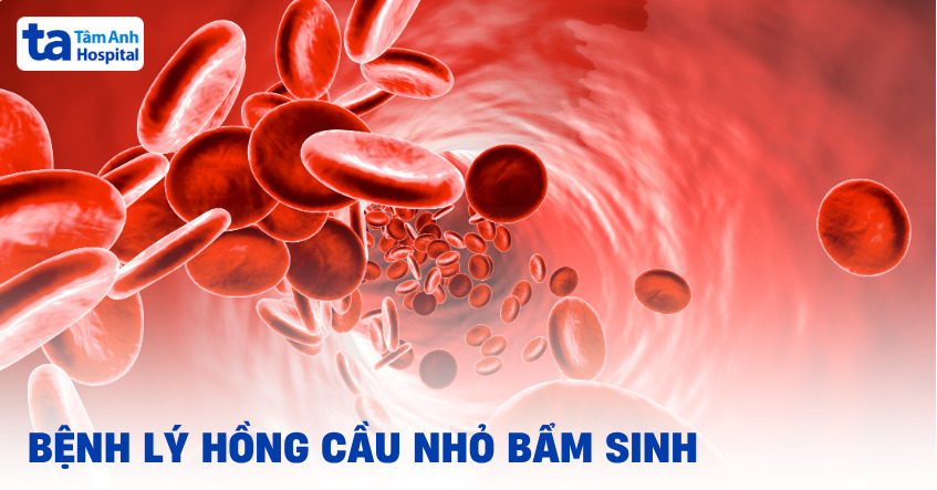 Bệnh lý hồng cầu nhỏ bẩm sinh có chữa khỏi không?