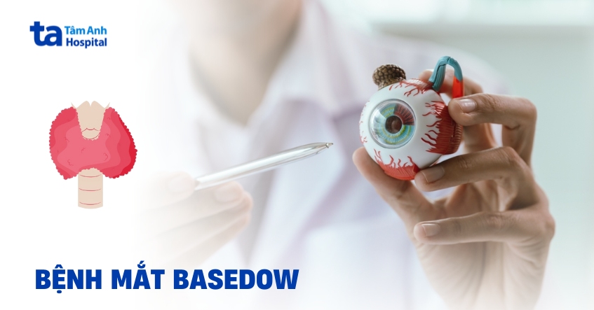Bệnh mắt Basedow có gây tổn thương nghiêm trọng không?