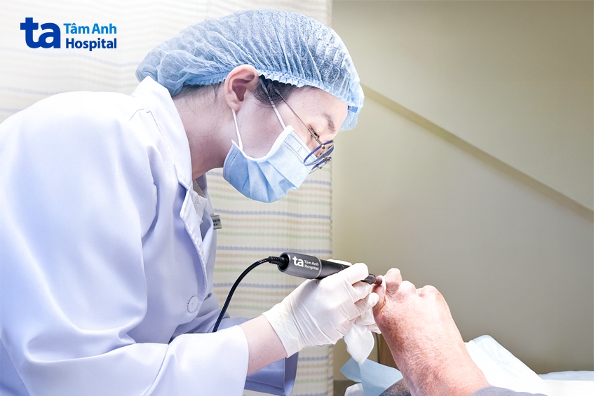 bệnh nhân bị đoạn ngón do biến chứng tiểu đường