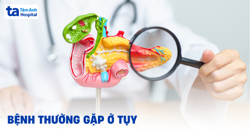 Các bệnh thường gặp ở tụy: Khi nào cần đi khám ngay?