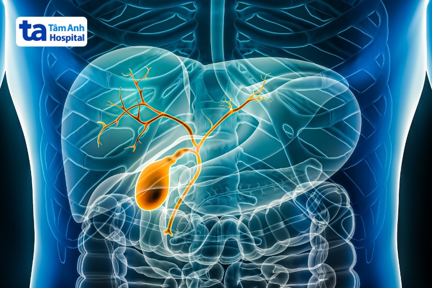 bệnh ứ mật trong gan