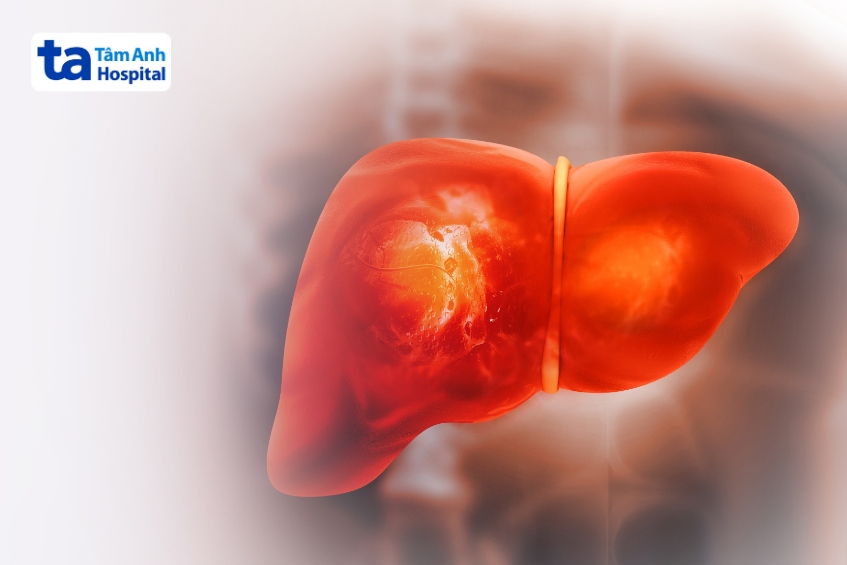 bệnh về gan mật