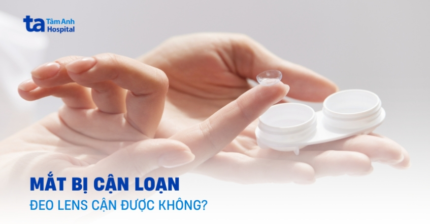 Mắt bị cận loạn đeo lens cận được không?