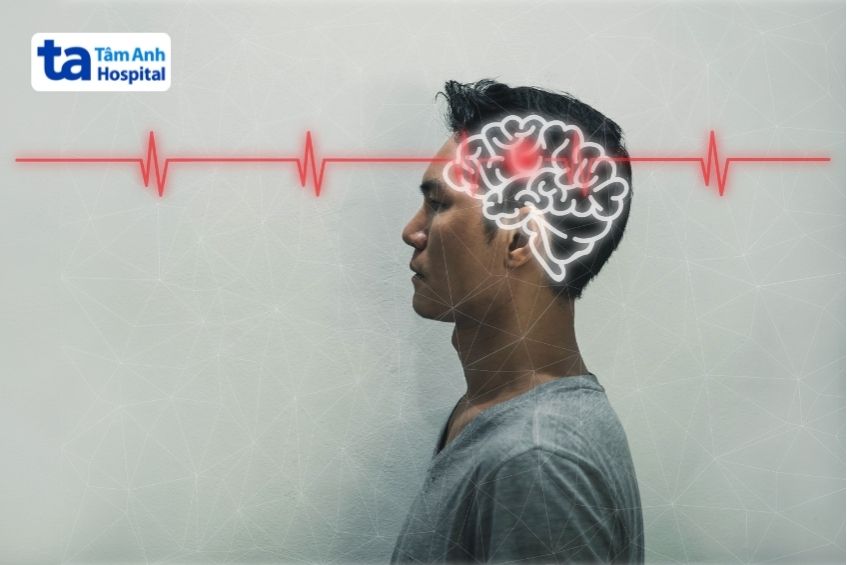 bị chấn động não bao lâu hồi phục tùy từng trường hợp