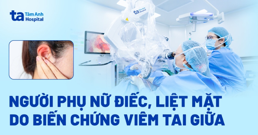 Người phụ nữ điếc, liệt mặt do biến chứng viêm tai giữa