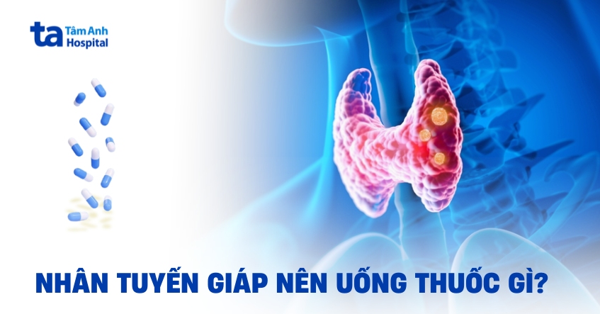 Hỏi đáp: Bị nhân tuyến giáp nên uống thuốc gì?