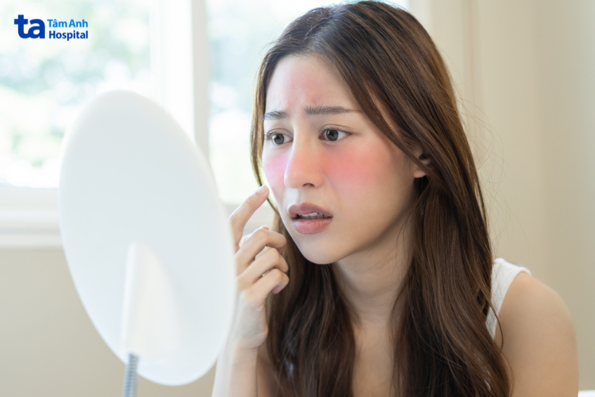 bị phỏng sau peel có sao không