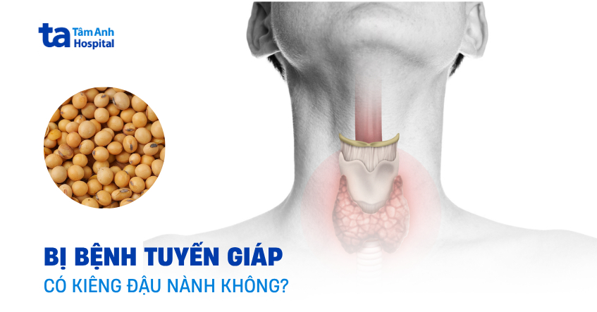 Khi bị tuyến giáp kiêng đậu nành không?
