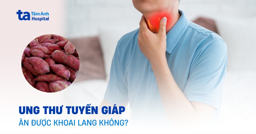 Bị ung thư tuyến giáp có ăn được khoai lang không?