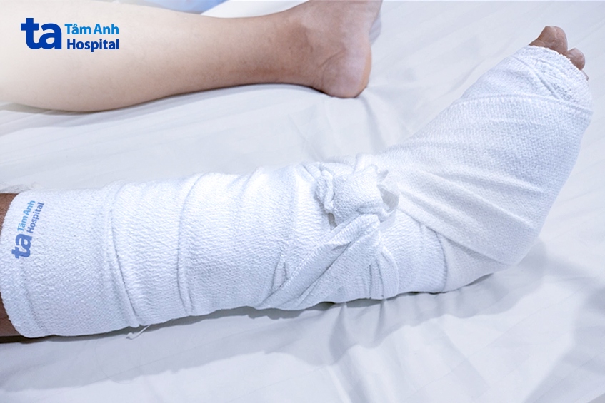 bỏ 3 ngón bàn chân phải do biến chứng tiểu đường