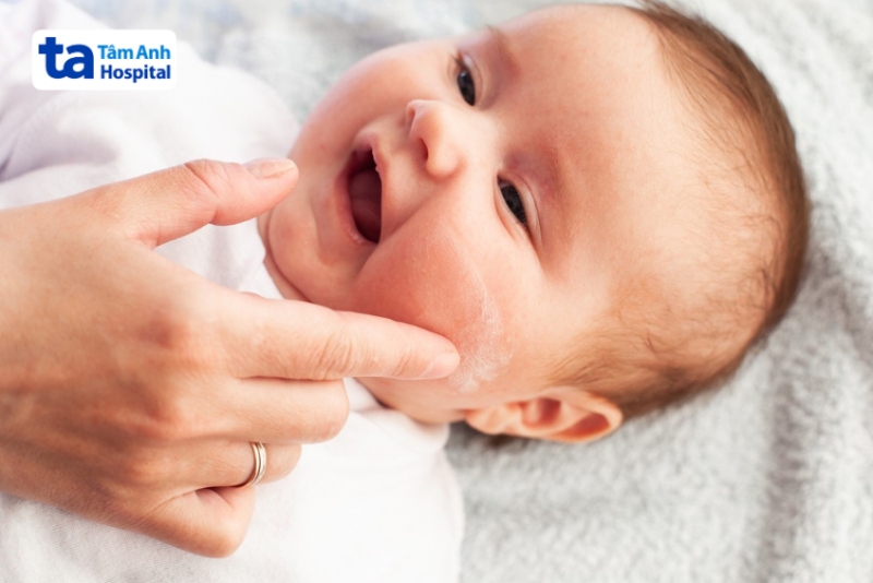 bôi kem dưỡng ẩm da