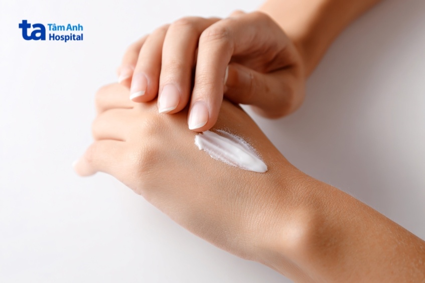 bôi kem dưỡng ẩm để phòng ngừa