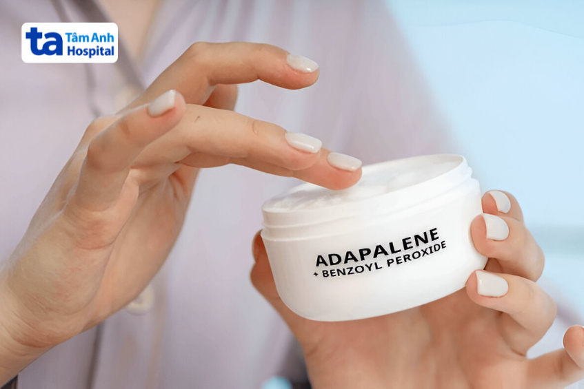 bôi kem hoặc thuốc chứa thành phần trị mụn