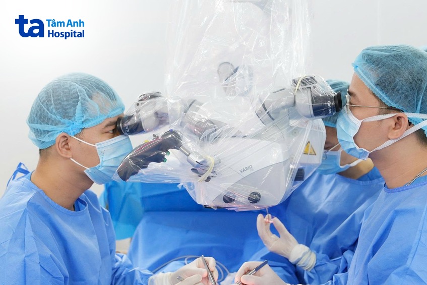 Bác sĩ IVF Tâm Anh đang thực hiện vi phẫu tìm tinh trùng cho người bệnh