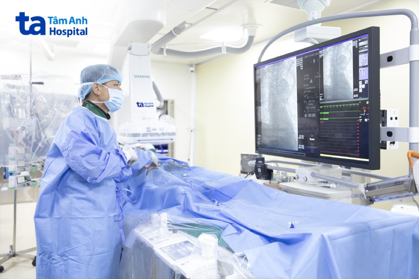 Bác sĩ Vĩnh đặt stent graft để củng cố thành mạch, ngăn ngừa vỡ, giảm áp lực và điều chỉnh dòng máu chảy cho ông Hưng