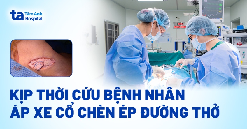 Kịp thời cứu bệnh nhân áp xe cổ chèn ép đường thở