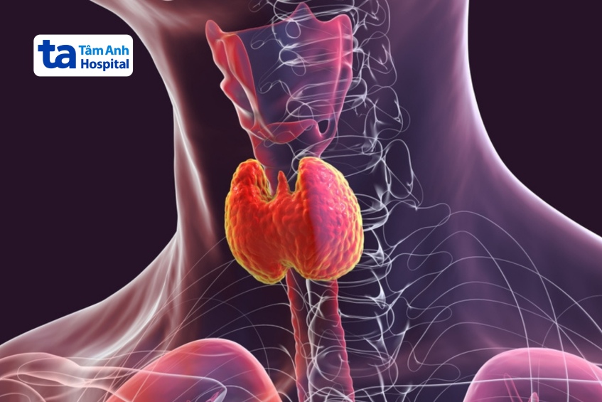 cả thừa và thiếu iốt đều có thể ảnh hưởng xấu đến tuyến giáp