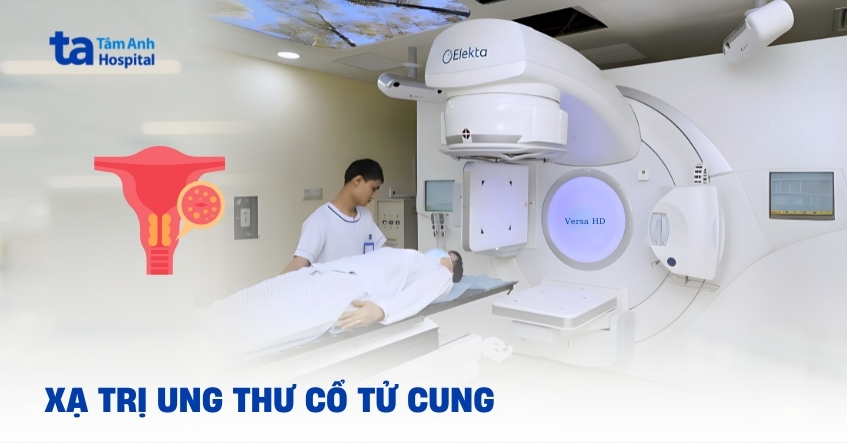 Cần biết gì về xạ trị ung thư cổ tử cung?