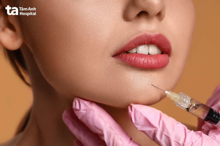 cần lựa chọn địa chỉ uy tín để tiêm filler