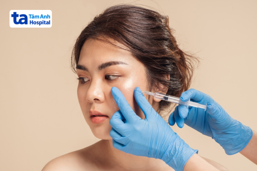cần tiêm tan filler để ngừa biến chứng
