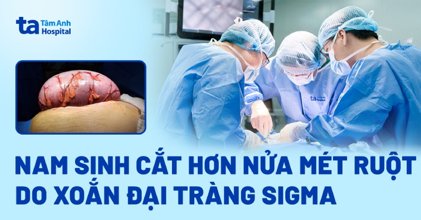 Nam sinh cắt hơn nửa mét ruột do xoắn đại tràng sigma