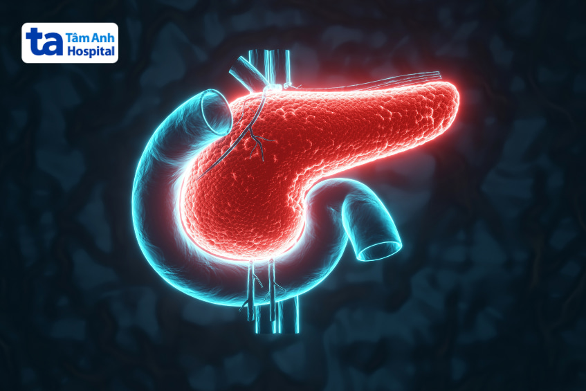 Minh họa cấu tạo tuyến tụy trong hệ tiêu hóa, liên quan các bệnh thường gặp ở tụy như viêm tụy và ung thư tụy