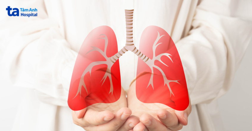 Hình minh họa phổi liên quan đến viêm phổi cộng đồng, một chỉ định điều trị quan trọng của kháng sinh ceftaroline