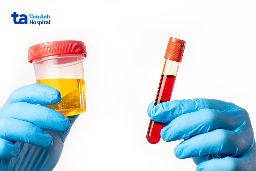 chẩn đoán huyết khối tĩnh mạch thận