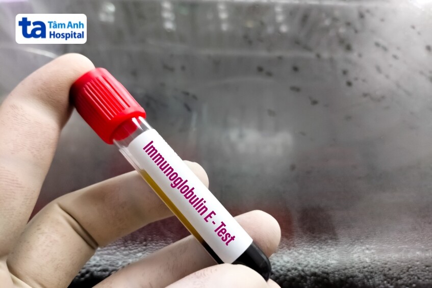 chẩn đoán viêm da tiếp xúc do protein