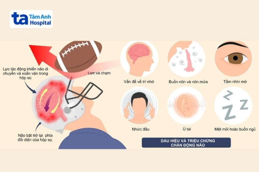 chấn động não gây mất trí