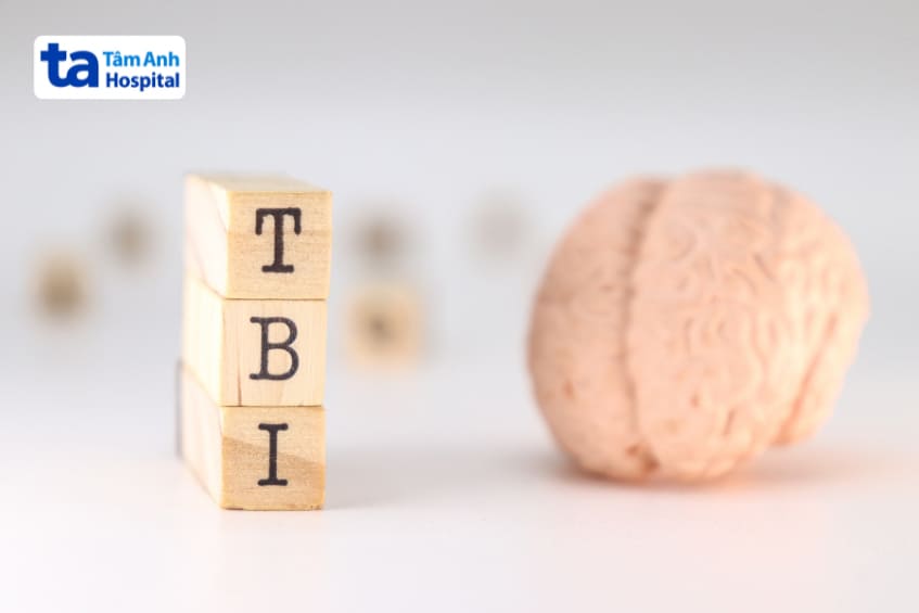 chấn thương sọ não có thể là nguyên nhân