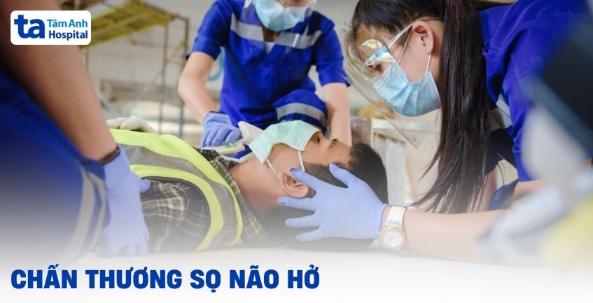 Hiểu đúng về chấn thương sọ não hở