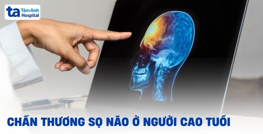 Chấn thương sọ não ở người cao tuổi khác biệt như thế nào?