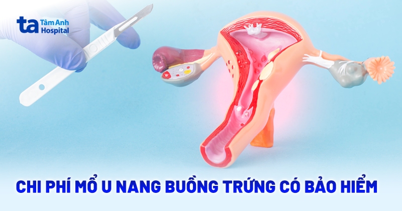 Chi phí mổ u nang buồng trứng có bảo hiểm​ chi trả bao nhiêu?