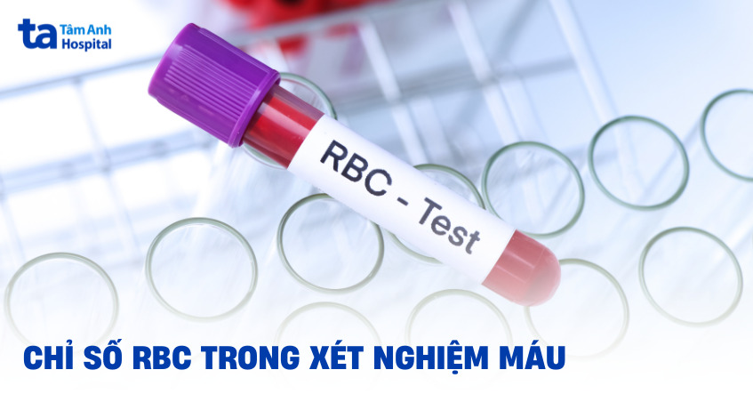 Chỉ số RBC cao hay thấp báo bệnh gì trong xét nghiệm máu