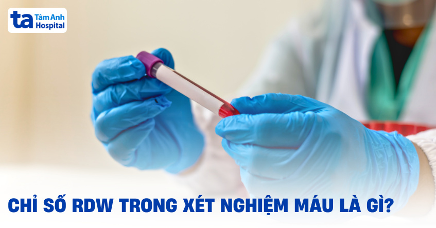 Chỉ số RDW trong xét nghiệm máu nói lên điều gì?