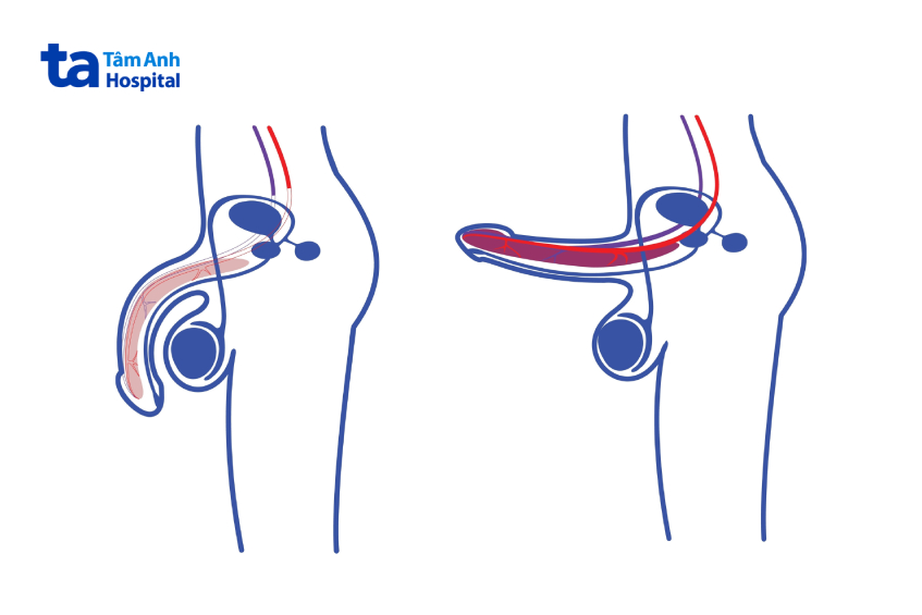 Chiều dài dương vật có thể đạt đến 13cm ở trạng thái cương hết cỡ
