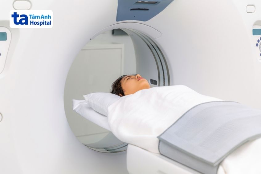 chụp CT não sử dụng tia X để tạo ra hình ảnh cắt lát của hộp sọ và não.