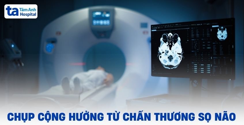 Vai trò của chụp cộng hưởng từ trong chấn thương sọ não