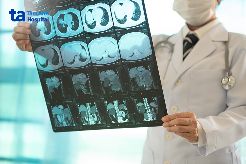 chụp CT hình ảnh rõ nét