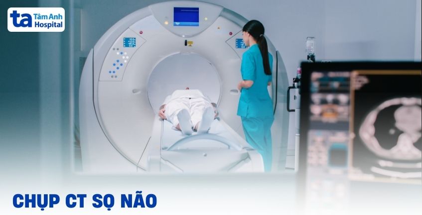 Chụp CT sọ não và các thông tin quan trọng