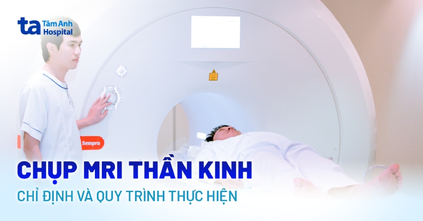 Chụp MRI thần kinh: Chỉ định và quy trình thực hiện