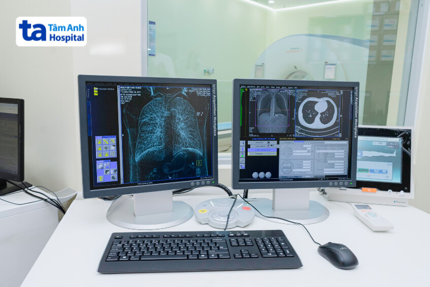 chụp toàn cơ thể trong 1 lần quét